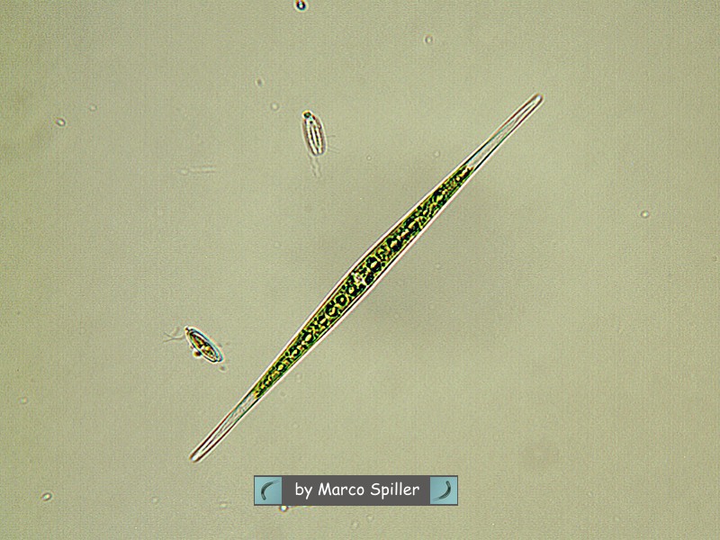 Closterium pronum....o che altro ?